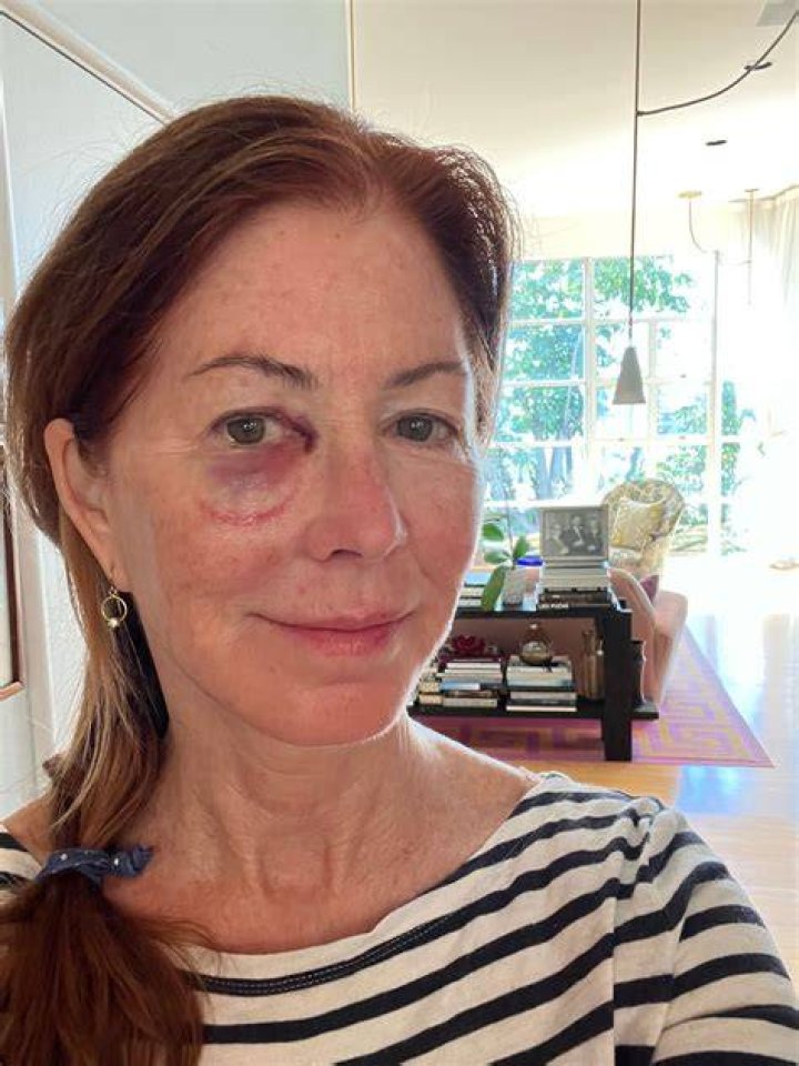 Dana Delany on Twitter "Me at 26. Dana Welles Delany. Can&rsquo;t wait to