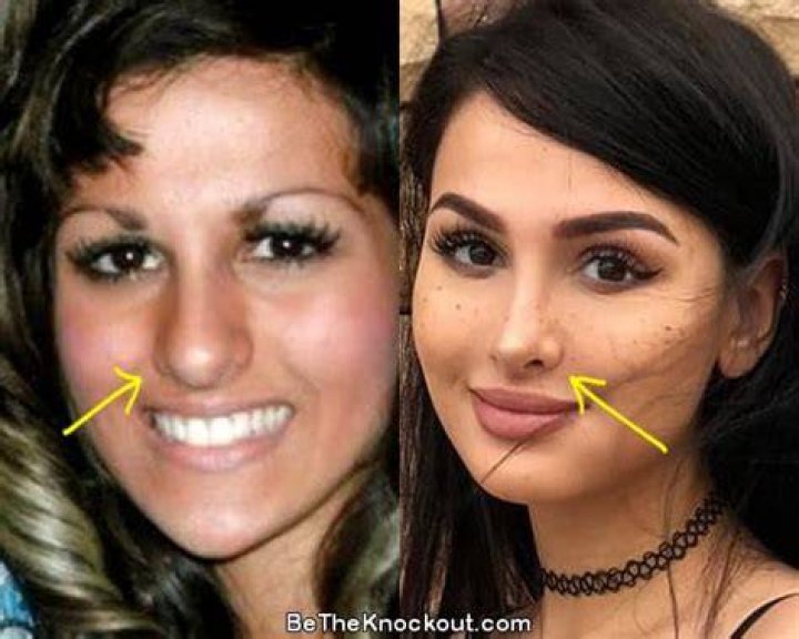 Did SSSniperWolf Get Plastic Surgery? Facts and Rumors! Plastic