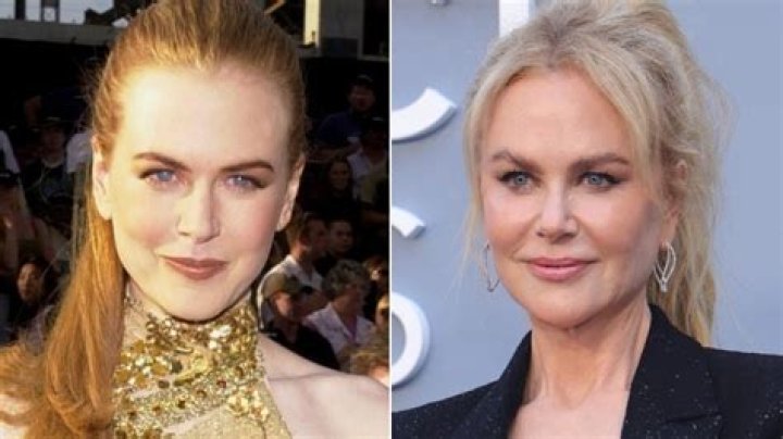 Has Nicole Kidman had a boob job? Mirror Online