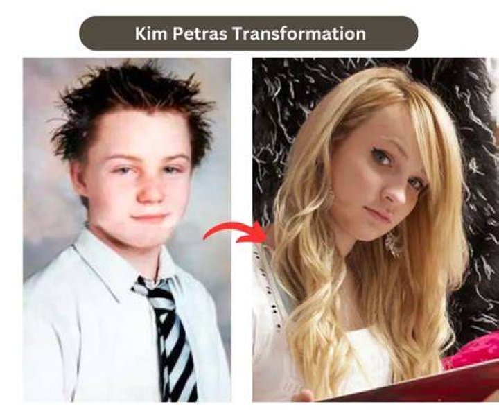 Kim Petras Before And After