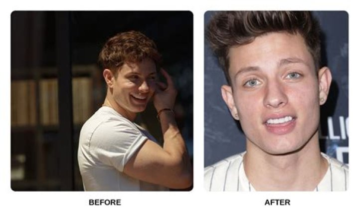 Matt Rife Before Fake Teeth Breaking News in USA Today