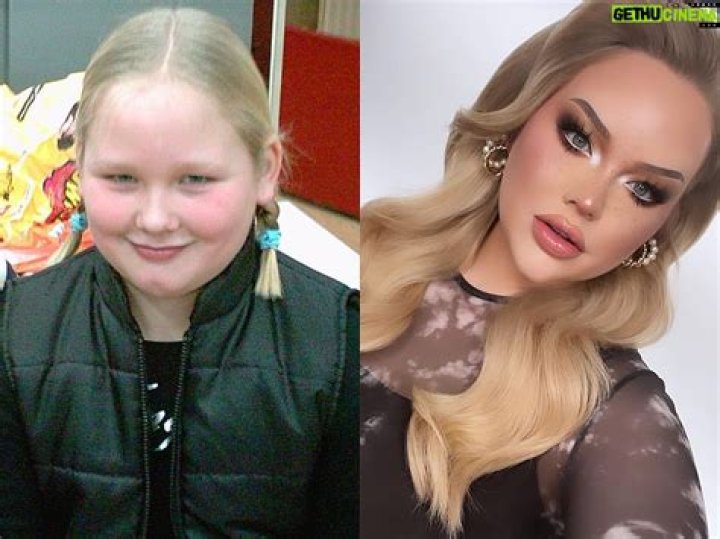 Nikkie De Jager Botox Before And After Photos Husband Dylan Drossaers
