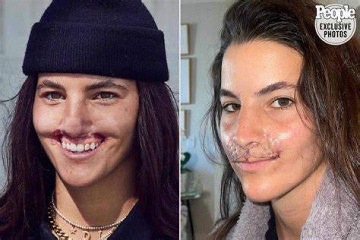 Skateboarder and Model Brooklinn Khoury Reflects on 'How Far I've Come