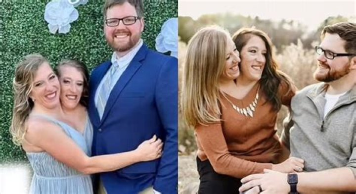 Tragic End: The Heartbreaking Loss Of The Hensel Twins In 2021