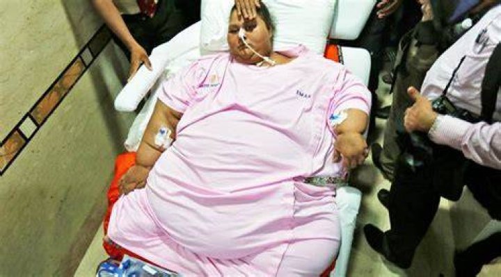 Worlds Heaviest Woman Eman Ahmed Loses Over 100 kg In 3 Weeks Through